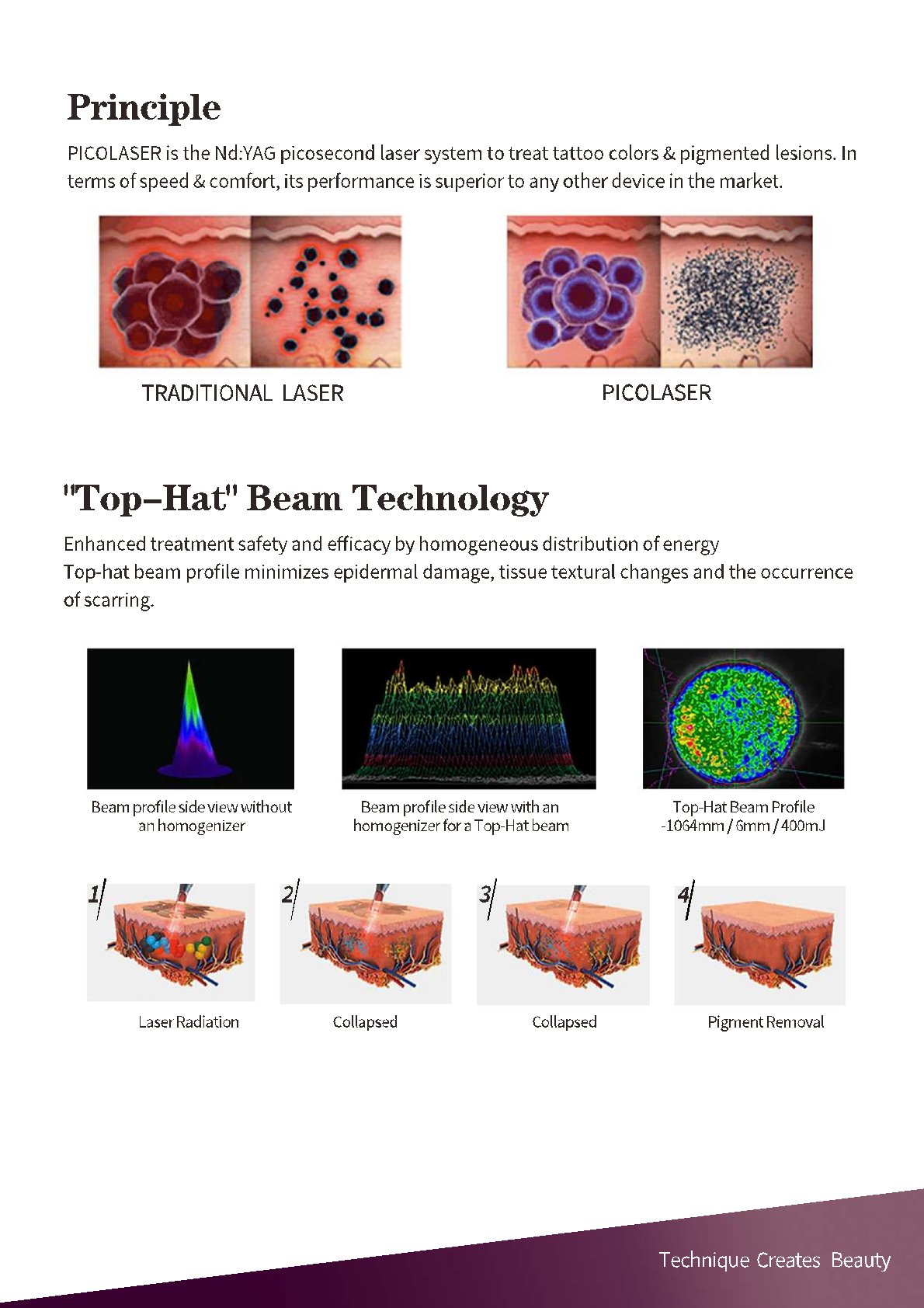 Công nghệ picosecond Top-Hat phân tán trải đều năng lượng so sánh công nghệ nanosecond 
