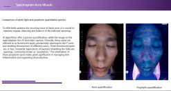 Soi mụn máy soi AISKIN